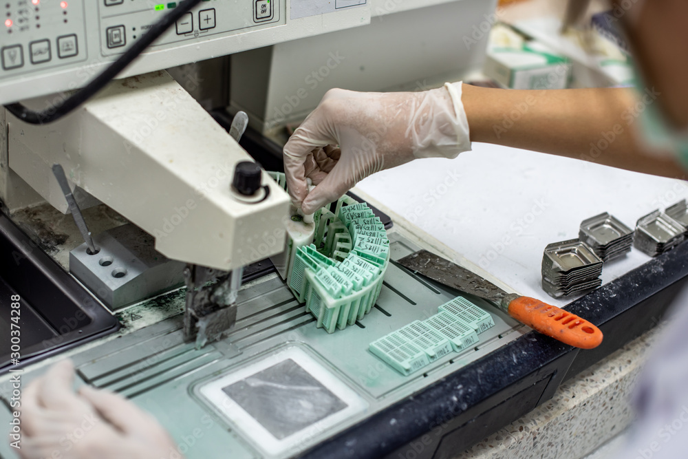 Pathological officers are preparing a biopsy for diagnosis by a pathologist. Pathological officers are preparing a biopsy for diagnosis by a pathologist.