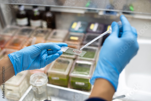 The pathologist is preparing a slide for the pathologist to diagnose.