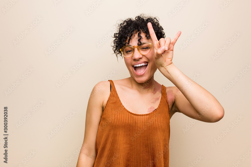 Young african american woman with skin birth mark showing a horns gesture as a revolution concept. Young african american woman with skin birth mark showing a horns gesture as a revolution concept.