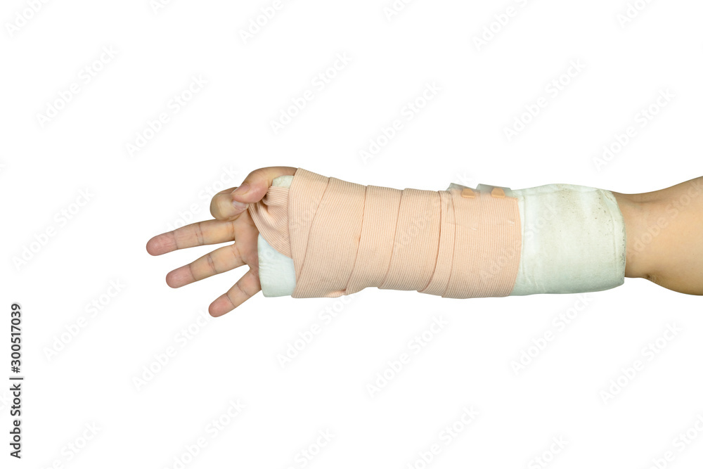 Hand making physical therapy to broken wrist from accident isolated on white background,clipping path Hand making physical therapy to broken wrist from accident isolated on white background,clipping path