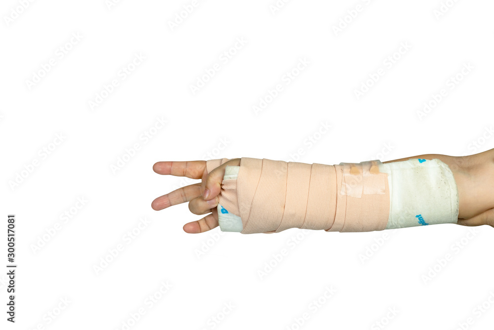 Hand making physical therapy to broken wrist from accident isolated on white background,clipping path Hand making physical therapy to broken wrist from accident isolated on white background,clipping path