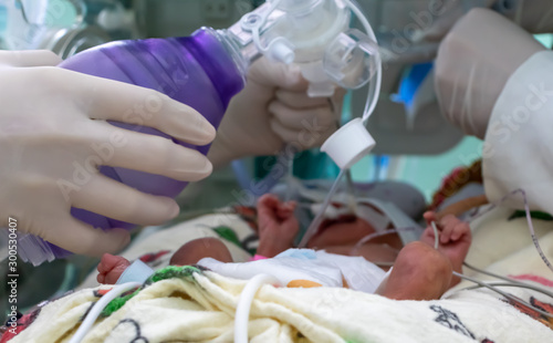 Critically ill Baby inside incubator, assisted ventilation through orotraqueal tube by physician. Nurse and doctor´s hands with gloves. NICU. Close up. Neonate. 