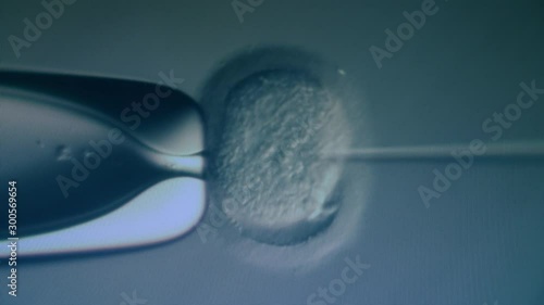 IVF, extracorporal fertilization process. Magnified artificial fertilization of an egg cell photo