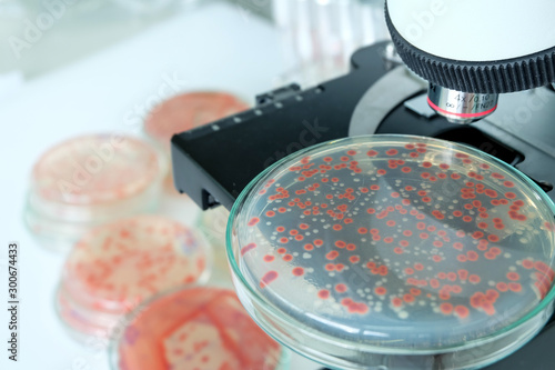 red colony of bacteria in laboratory photo