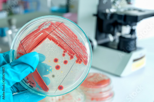 red colony of bacteria in laboratory