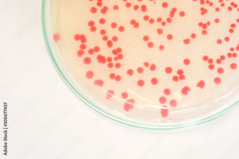 red colony of bacteria in laboratory