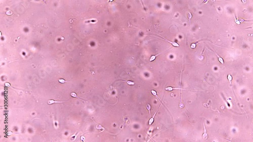Sperm under the microscope, the movement of sperm cells in the seminal fluid, spermatozoa are the gamete male reproductive cell, have the ability to actively move and serve to fertilize the female egg