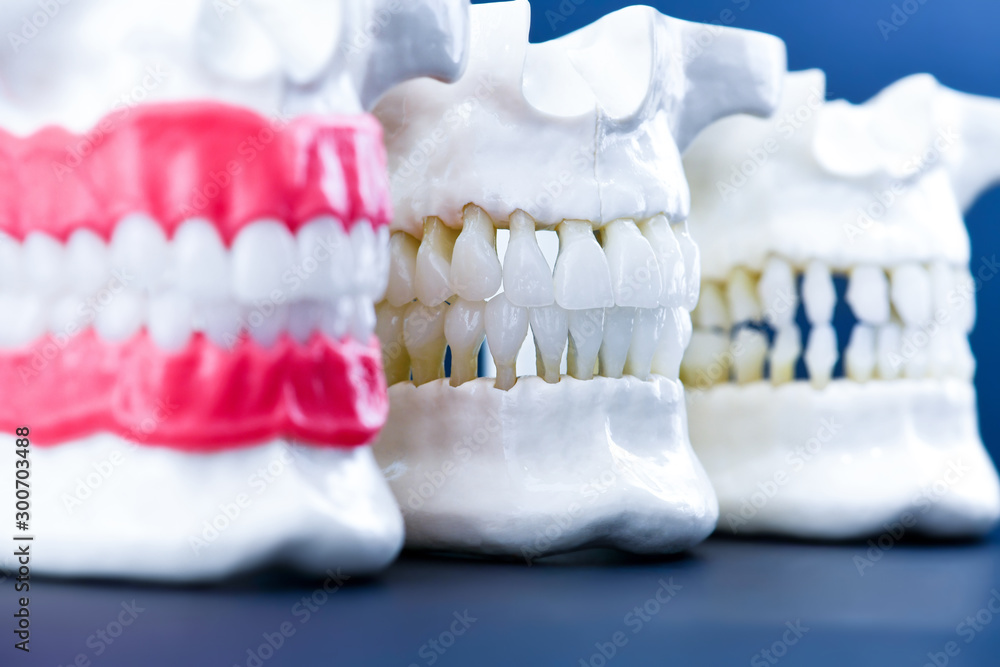 Fototapeta premium Human jaws with teeth and gums anatomy models