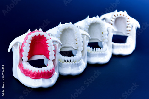 Dentist orthodontic teeth models