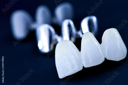 Billede på lærred different types of dental tooth crowns