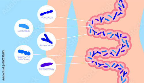 infographic types of probiotics in the gut. flat vector illustration. Propionibacterium, Streptococcus thermophilus, Lactococcus, Bifidobacterium, Lactobacillus. concept good bacteria for microflora. 