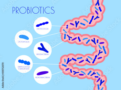 infographic types of probiotics in the gut. flat vector illustration. Propionibacterium, Streptococcus thermophilus, Lactococcus, Bifidobacterium, Lactobacillus. concept good bacteria for microflora. 