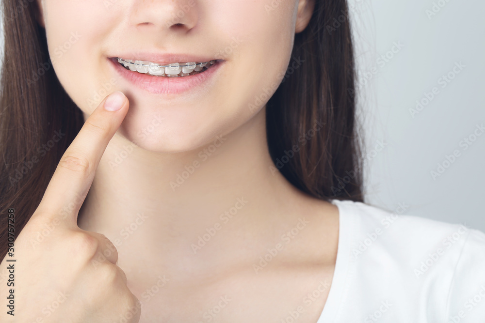 Young girl showing on dental braces by finger Young girl showing on dental braces by finger