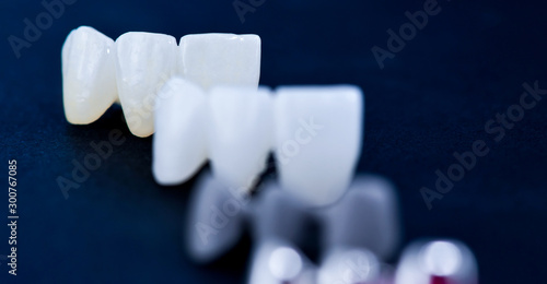 Фотография different types of dental tooth crowns