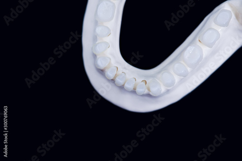 Lower human jaw with teeth isolated on black background
