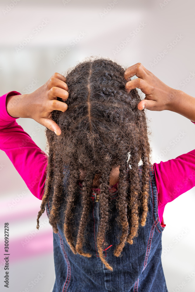 girl itchy his hair on isolated w indoors background, health care concept back view girl itchy his hair on isolated w indoors background, health care concept back view
