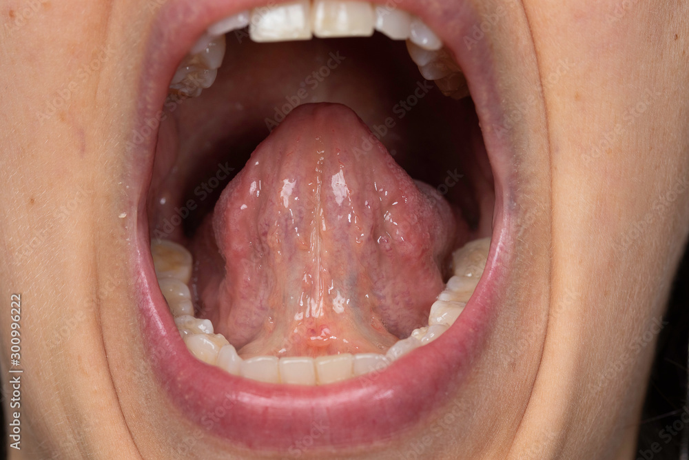 Obraz premium Human tongue hyoid frenum close up