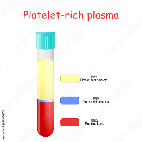 Platelet-rich plasma. layers of blood in test tube.