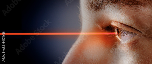 eye laser surgery concept photo