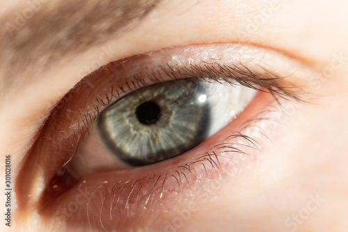 close up of human eye with sun spot