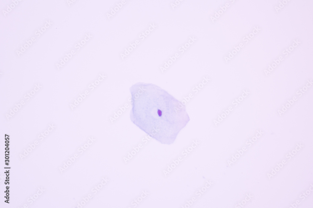 View in microscopic of normal human cervix cells.Squamous epithelium