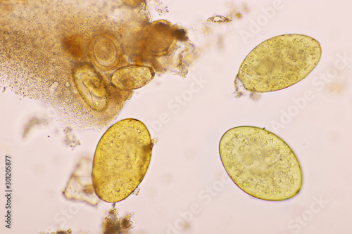 Eggs of intestinal fluke in human stool, analyze by microscope, original magnification 400x photo