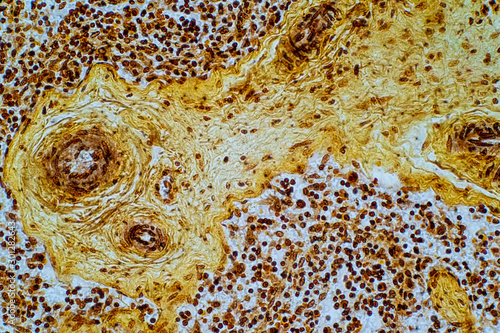 Billede på lærred Reticular cell is a type of fibroblast