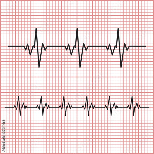 Heart beat monitor pulse line. Cardiogram, health EKG or ECG.