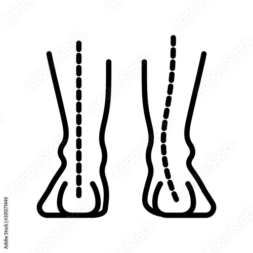 Ankle arch, human foot pathology isolated line icon