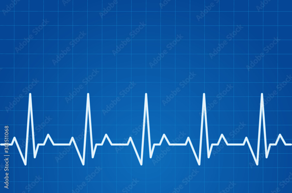 ECG heartbeat monitor, cardiogram heart pulse line wave. Electrocardiogram medical background.