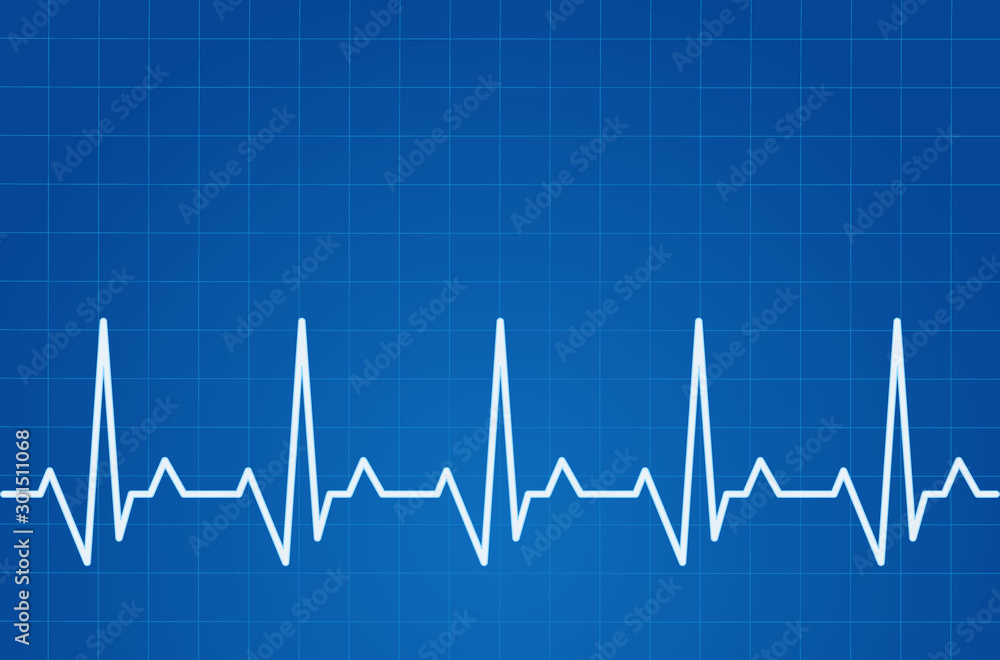 ECG heartbeat monitor, cardiogram heart pulse line wave. Electrocardiogram medical background. ECG heartbeat monitor, cardiogram heart pulse line wave. Electrocardiogram medical background.