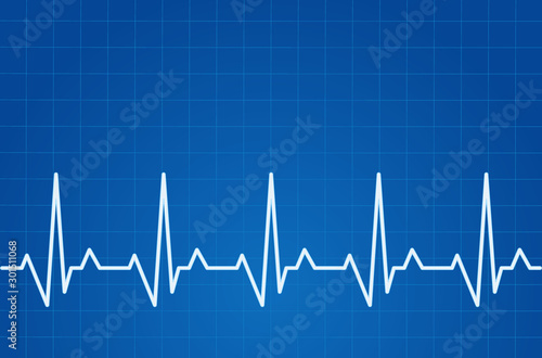 ECG heartbeat monitor, cardiogram heart pulse line wave. Electrocardiogram medical background.