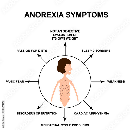 Anorexia symptoms. Slim physique with anorexia. Infographics. Vector illustration on isolated background.