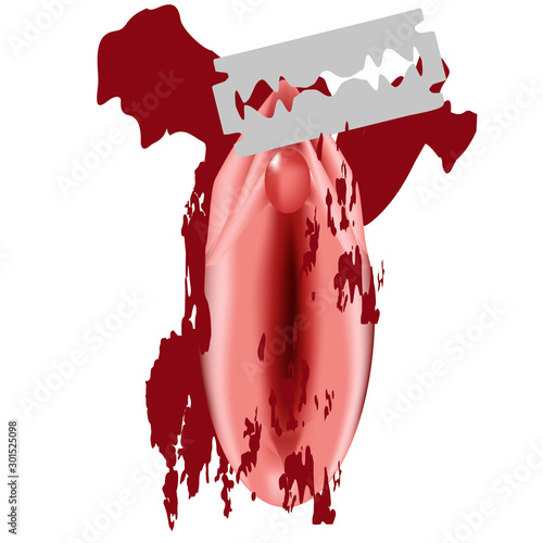International Day of Zero Tolerance for Female Genital Mutilation. Female external genitalia. The vulva blade cuts. Female circumcision. Circumcision of the vulva and clitoris in Muslims. Vector