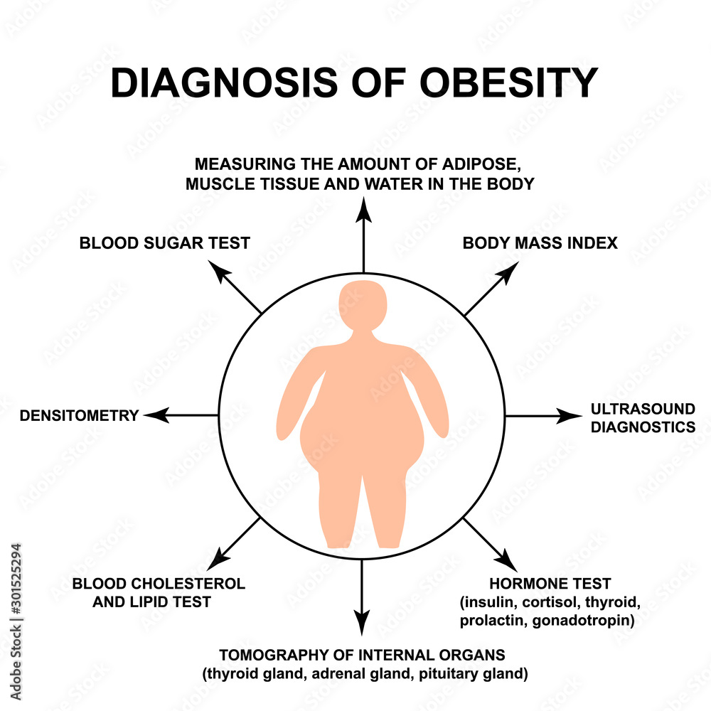 Obraz premium Diagnosis of obesity. World Obesity Day. Silhouette of a fat man. Infographics. Vector illustration on isolated background.