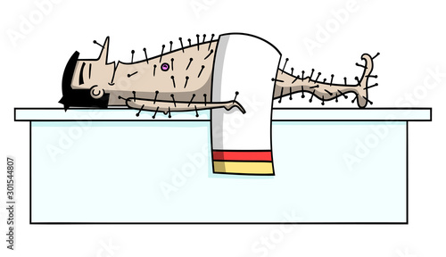 Cartoon style illustration of a man lying on a table getting acupuncture treatment.