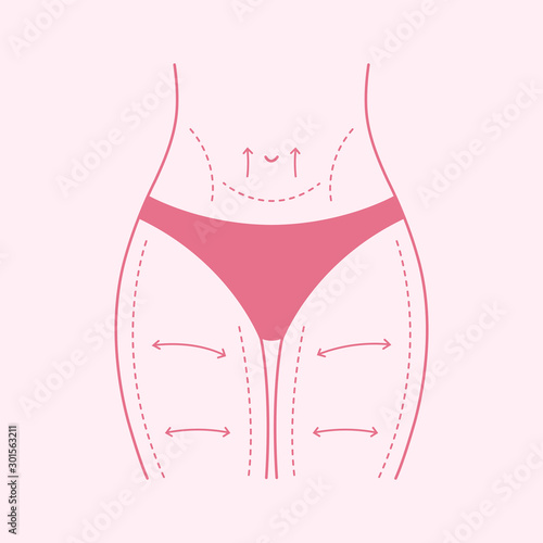 Vector liposuction surgery concept. Woman figure line icon. Beauty care illustration.Plastic surgery. Waist correction.