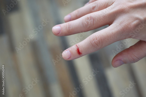 Finger with blood drop. Injured by sharp knife.
