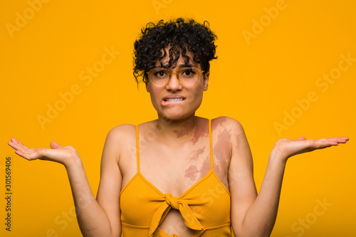 Young african american woman with skin birth mark confused and doubtful shrugging shoulders to hold a copy space.