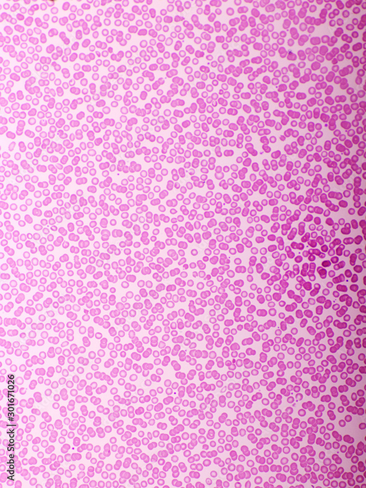 Red blood cells in blood smear, Wright-Giemsa stain, analyze by microscope, 400x Red blood cells in blood smear, Wright-Giemsa stain, analyze by microscope, 400x