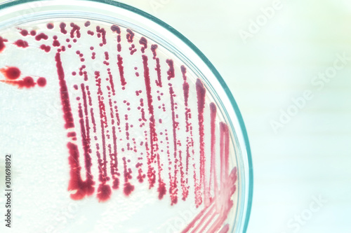 colony of bacteria in petridish