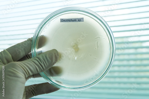 colony of fungi in petridish with microbiology concept