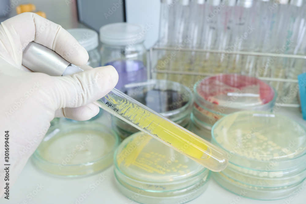 colony of bacteria in test tube colony of bacteria in test tube