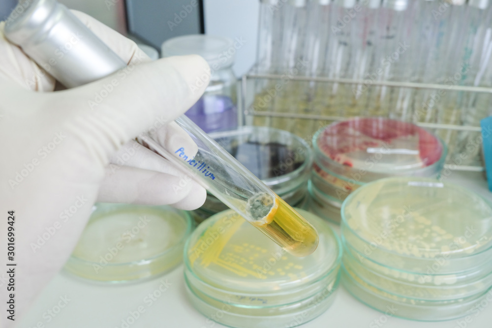 colony of fungi in test tube with microbiology concept colony of fungi in test tube with microbiology concept