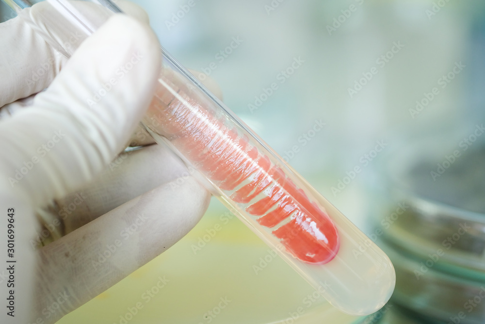 colony of bacteria in test tube colony of bacteria in test tube
