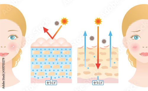 セラミド　健康な肌　乾燥肌 
