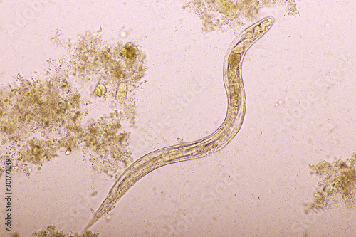 Strongyloides stercoralis or threadworm in human stool, analyze by microscope, original magnification 400x photo