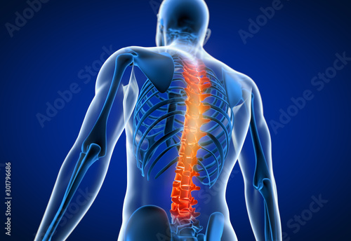 3d rendered medically accurate illustration of a man having a painful back photo