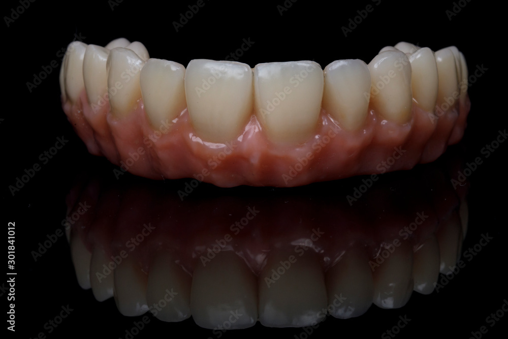 dental prosthesis made of zircon or ceramics of the upper jaw with a pink gum on black glass dental prosthesis made of zircon or ceramics of the upper jaw with a pink gum on black glass