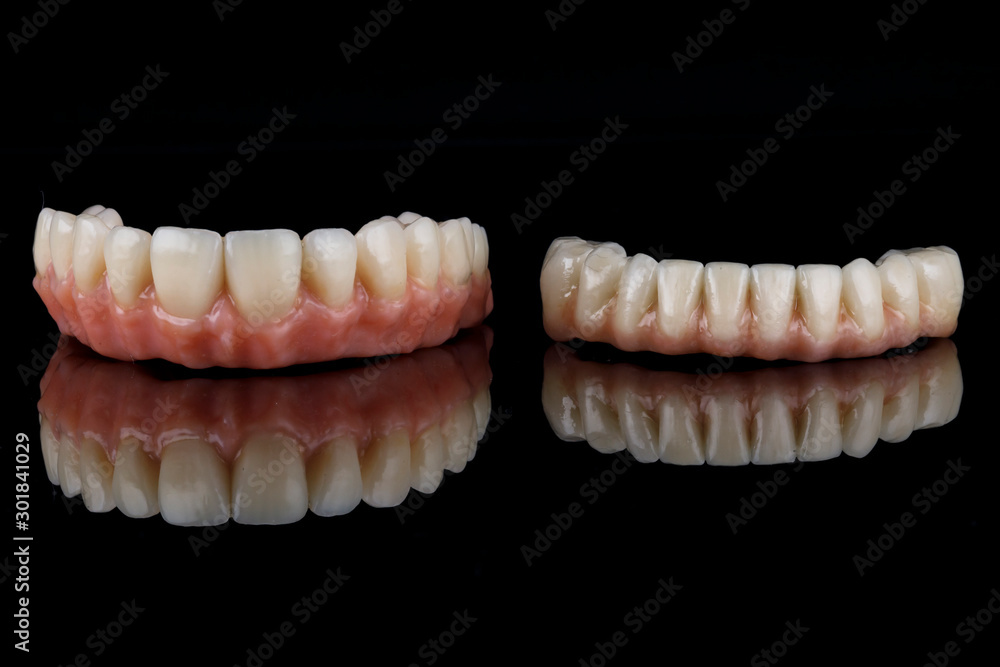 high-quality dentures of the upper and lower jaw with a pink gum on black glass high-quality dentures of the upper and lower jaw with a pink gum on black glass